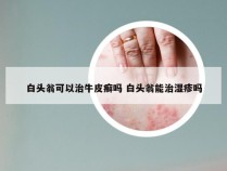 白头翁可以治牛皮癣吗 白头翁能治湿疹吗