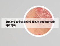 莫匹罗星软膏治皮癣吗 莫匹罗星软膏治皮癣吗有用吗