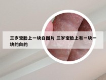 三岁宝脸上一块白图片 三岁宝脸上有一块一块的白的