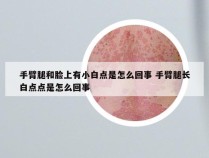 手臂腿和脸上有小白点是怎么回事 手臂腿长白点点是怎么回事