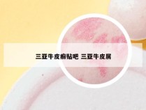 三亚牛皮癣贴吧 三亚牛皮屑