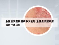 急性点滴型银屑病多久能好 急性点滴型银屑病用什么药愈