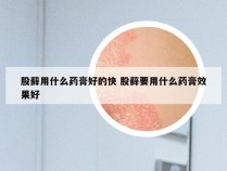 股藓用什么药膏好的快 股藓要用什么药膏效果好