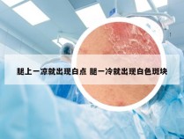 腿上一凉就出现白点 腿一冷就出现白色斑块