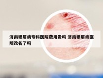 济南银屑病专科医院费用贵吗 济南银屑病医院改名了吗