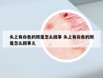 头上有白色的斑是怎么回事 头上有白色的斑是怎么回事儿