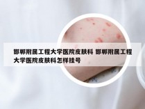 邯郸附属工程大学医院皮肤科 邯郸附属工程大学医院皮肤科怎样挂号