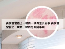 两岁宝宝脸上一块白一块白怎么回事 两岁宝宝脸上一块白一块白怎么回事啊