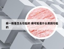 癣一般是怎么引起的 癣可能是什么原因引起的