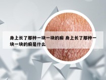 身上长了那种一块一块的癣 身上长了那种一块一块的癣是什么