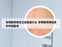 生物制剂用完之后复查什么 生物制剂用后多长时间起效