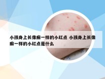 小孩身上长像癣一样的小红点 小孩身上长像癣一样的小红点是什么