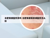 合肥银康医院贵吗 合肥银康银屑病医院怎么样