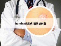 humira银屑病 银屑病科普