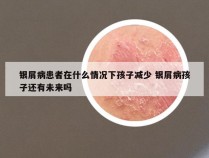 银屑病患者在什么情况下孩子减少 银屑病孩子还有未来吗