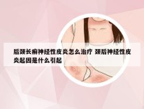 后颈长癣神经性皮炎怎么治疗 颈后神经性皮炎起因是什么引起