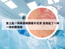 背上起一块癣很痒摸着不光滑 后背起了一块一块的癣很痒