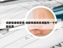 成都银康银屑病 成都银康银屑病医院一个疗程收费