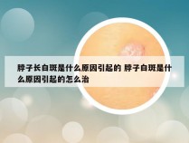 脖子长白斑是什么原因引起的 脖子白斑是什么原因引起的怎么治