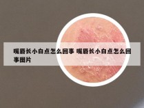 嘴唇长小白点怎么回事 嘴唇长小白点怎么回事图片