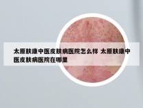 太原肤康中医皮肤病医院怎么样 太原肤康中医皮肤病医院在哪里