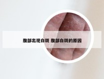 腹部出现白斑 腹部白斑的原因