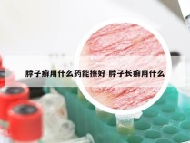 脖子癣用什么药能擦好 脖子长癣用什么