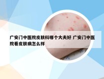 广安门中医院皮肤科哪个大夫好 广安门中医院看皮肤病怎么样