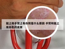 腿上和手臂上有白斑是什么原因 手臂和腿上有白色的皮屑