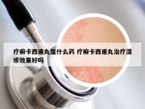 疗癣卡西甫丸是什么药 疗癣卡西甫丸治疗湿疹效果好吗