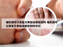 哺乳期可以用复方黄柏祛癣搽剂吗 哺乳期可以用复方黄柏祛癣搽剂吗孕妇