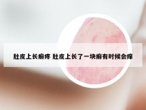 肚皮上长癣疼 肚皮上长了一块癣有时候会痒