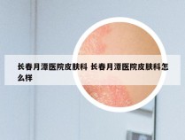 长春月潭医院皮肤科 长春月潭医院皮肤科怎么样