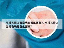 小孩儿脸上有白块儿怎么回事儿 小孩儿脸上出现白块是怎么回事?