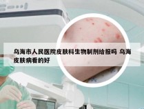 乌海市人民医院皮肤科生物制剂给报吗 乌海皮肤病看的好