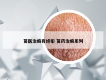 苗医治癣有绝招 苗药治癣系列