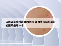 江西省皮肤科最好的医院 江西省皮肤科最好的医院是哪一个