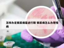 怎样办定银屑病是进行期 银屑病怎么办理慢病