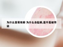 为什么容易有癣 为什么会起癣,是不是被传染