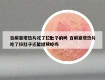 百癣夏塔热片吃了拉肚子的吗 百癣夏塔热片吃了拉肚子还能继续吃吗