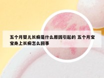 五个月婴儿长癣是什么原因引起的 五个月宝宝身上长癣怎么回事