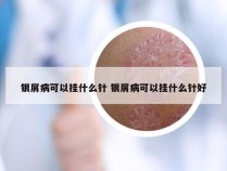 银屑病可以挂什么针 银屑病可以挂什么针好