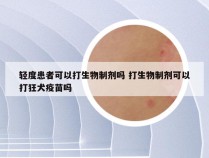 轻度患者可以打生物制剂吗 打生物制剂可以打狂犬疫苗吗