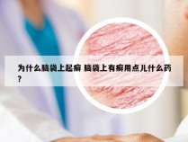 为什么脑袋上起癣 脑袋上有癣用点儿什么药?