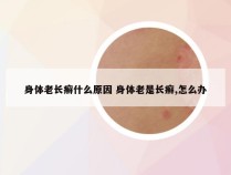 身体老长癣什么原因 身体老是长癣,怎么办