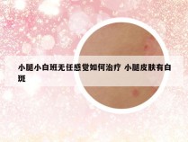 小腿小白班无任感觉如何治疗 小腿皮肤有白斑