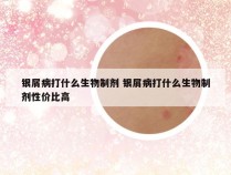 银屑病打什么生物制剂 银屑病打什么生物制剂性价比高