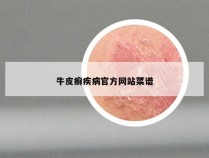 牛皮癣疾病官方网站菜谱