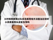 小时候用姜摸过头皮出癣用啥方法医治比较好 小孩用姜擦头皮能生发吗