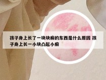 孩子身上长了一块块癣的东西是什么原因 孩子身上长一小块凸起小癣